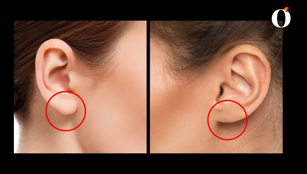 Test personalidad lóbulos