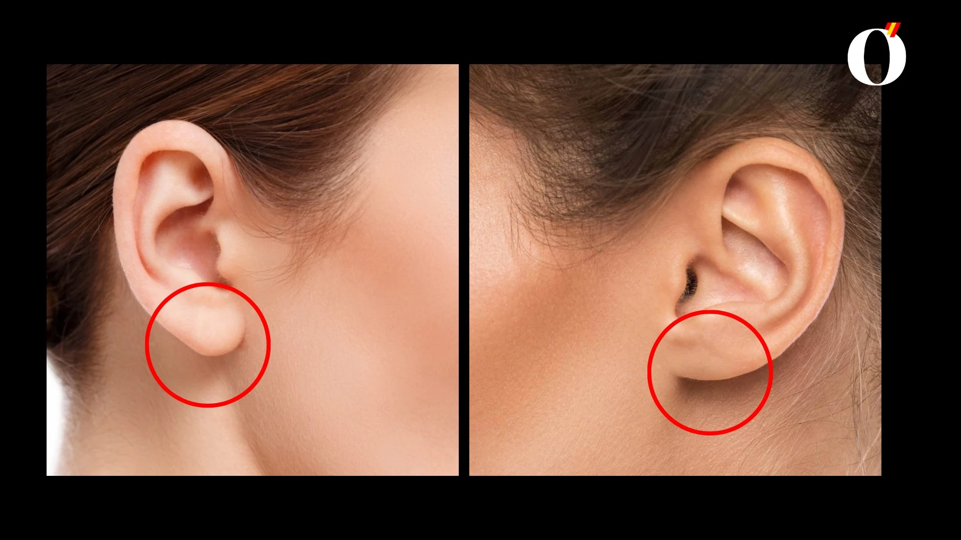 Test personalidad lóbulos