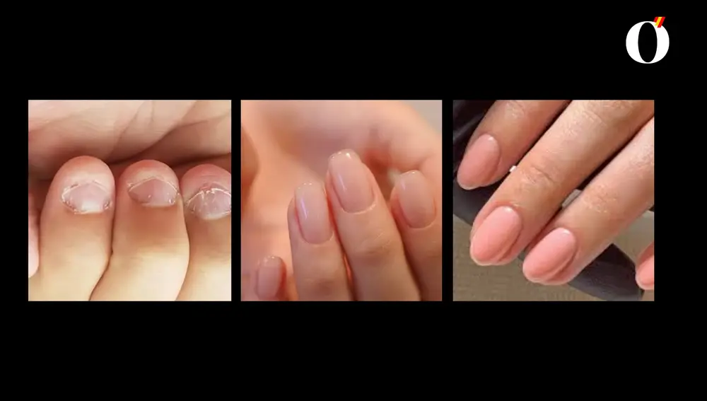 Test de personalidad uñas