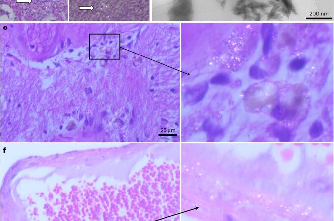 Microplásticos en muestras de cerebro