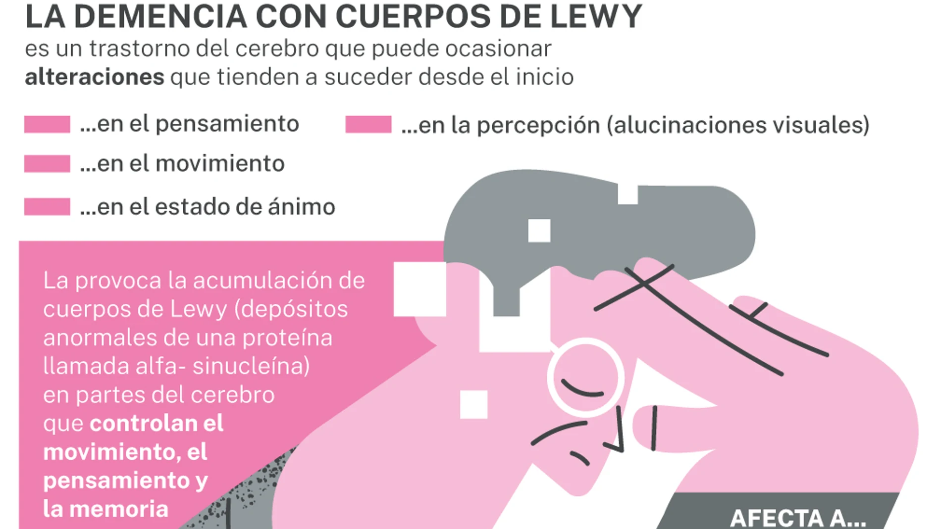 La demencia con cuerpos de Lewy