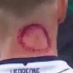 La insólita aclaración de un futbolista profesional tras una marca en el cuello: "No me mordió un zombi"
