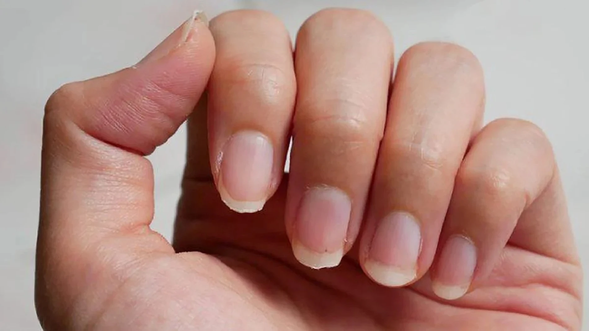 ¿Tienes esta marca blanca en las uñas? Un genetista de Harvard dice que podría revelar cuánto vivirás