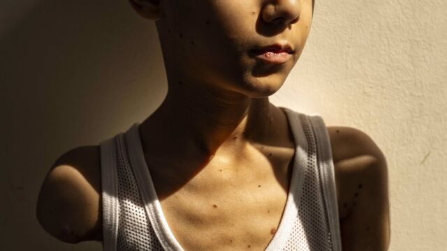 VÍDEO: La imagen de un niño mutilado en un ataque en Gaza, foto del año del World Press Photo 2025