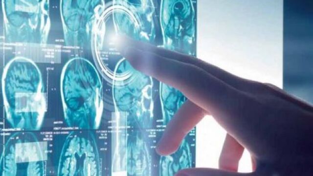 Este hallazgo puede tener amplias implicaciones en la forma en que se estudian enfermedades como el párkinson y el alzhéimer
