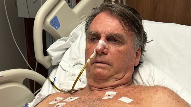 Brasil.- Bolsonaro sigue en fase de recuperación "positiva" tras su intervención pero sin salida a la vista de la UCI