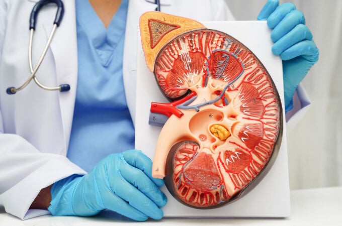 El cáncer de riñón es, tras el de próstata y vejiga, el tercer tumor urológico más frecuente