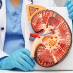El cáncer de riñón es, tras el de próstata y vejiga, el tercer tumor urológico más frecuente