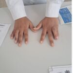 Las manos de un niño que fue operado los médicos españoles