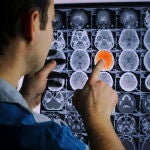 Oncología Tratamientos 