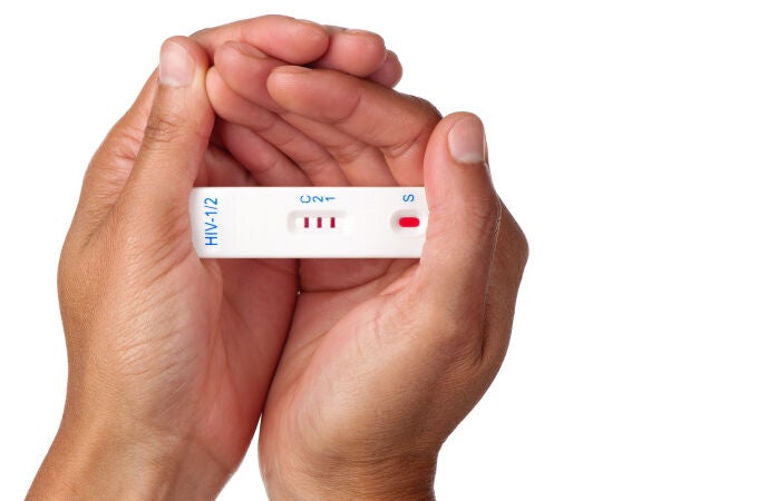 Un diagnóstico tardío está asociado a una mayor progresión de la infección