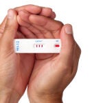 Un diagnóstico tardío está asociado a una mayor progresión de la infección