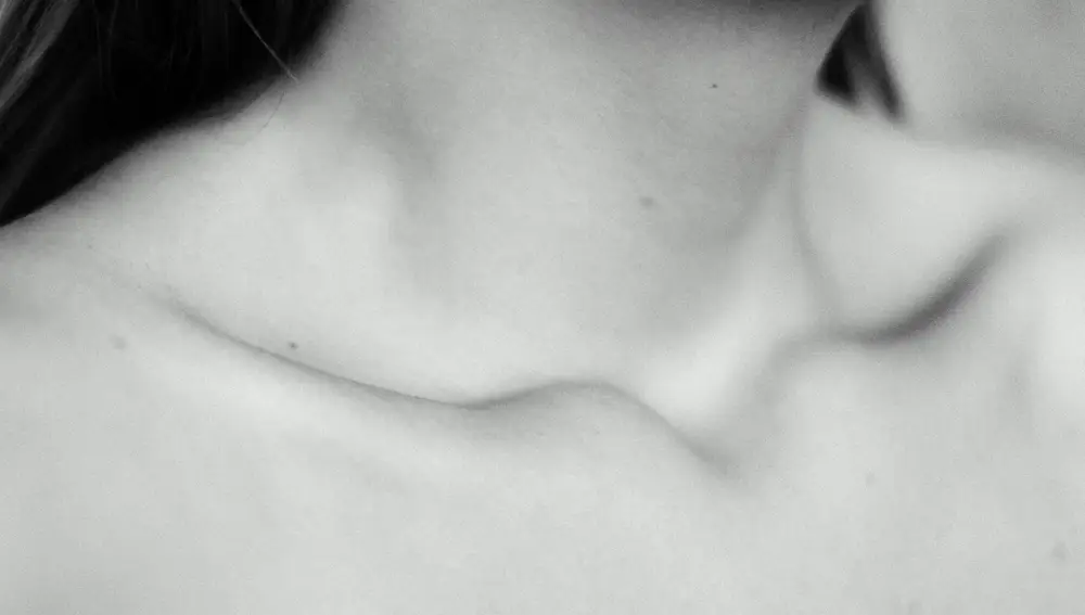 Verrugas en cuello y axilas: qué significan y cómo eliminarlas de forma natural
