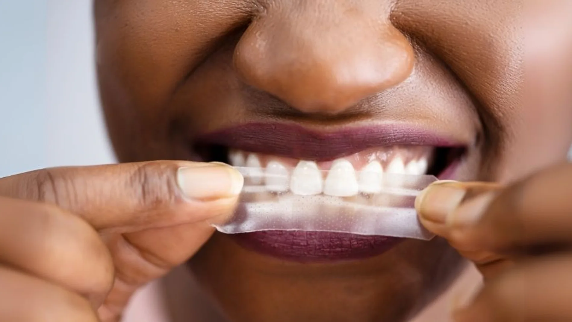 tiras blanqueadoras dentales