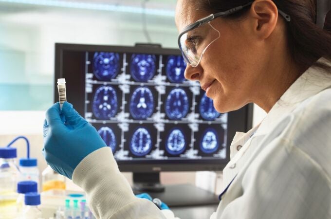 Una científica de España contribuye a dar un salto revolucionario en alzheimer