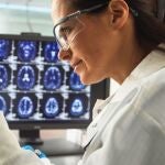 Una científica de España contribuye a dar un salto revolucionario en alzheimer