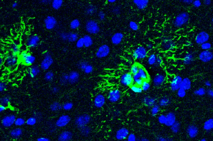 Descubren cómo una proteína provoca cambios tempranos en el cerebro que anticipan el alzhéimer 