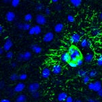 Descubren cómo una proteína provoca cambios tempranos en el cerebro que anticipan el alzhéimer 