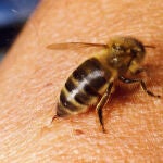 Inyección de apitoxina de una abeja melífera