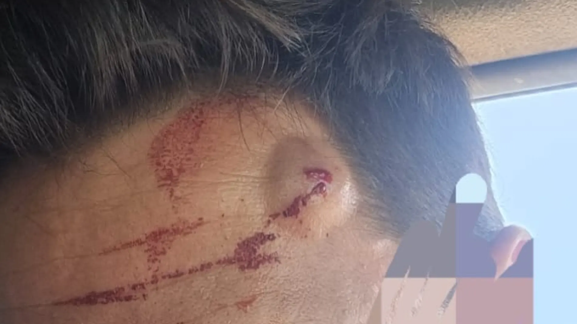 Las heridas de un guardia civil al tratar de impedir un salto en la valla de Ceuta