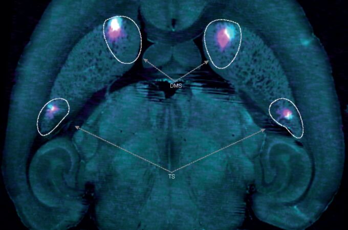 Estas son las dos zonas implicadas en el aprendizaje en nuestro cerebro