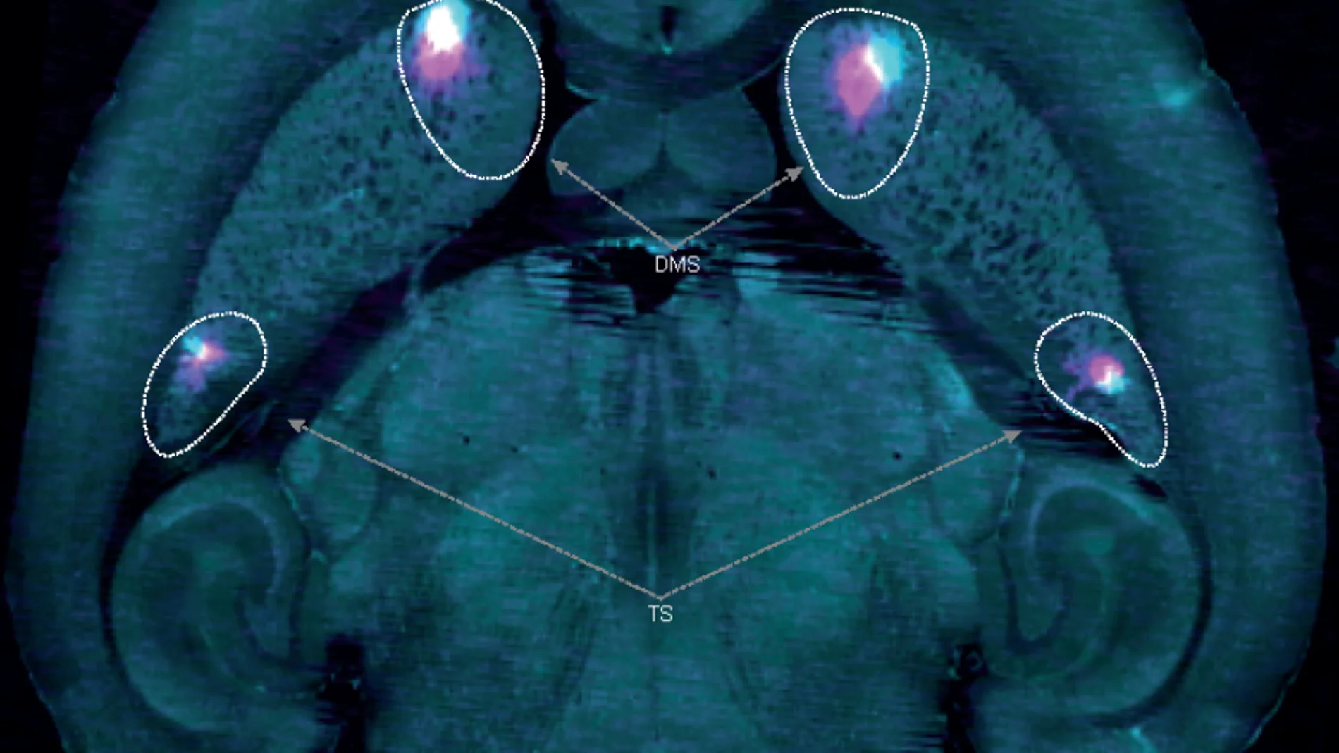 Cerebro