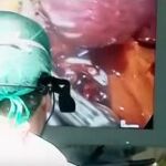 El Hospital Río Hortega de Valladolid se consolida a la vanguardia en innovación y excelencia quirúrgica