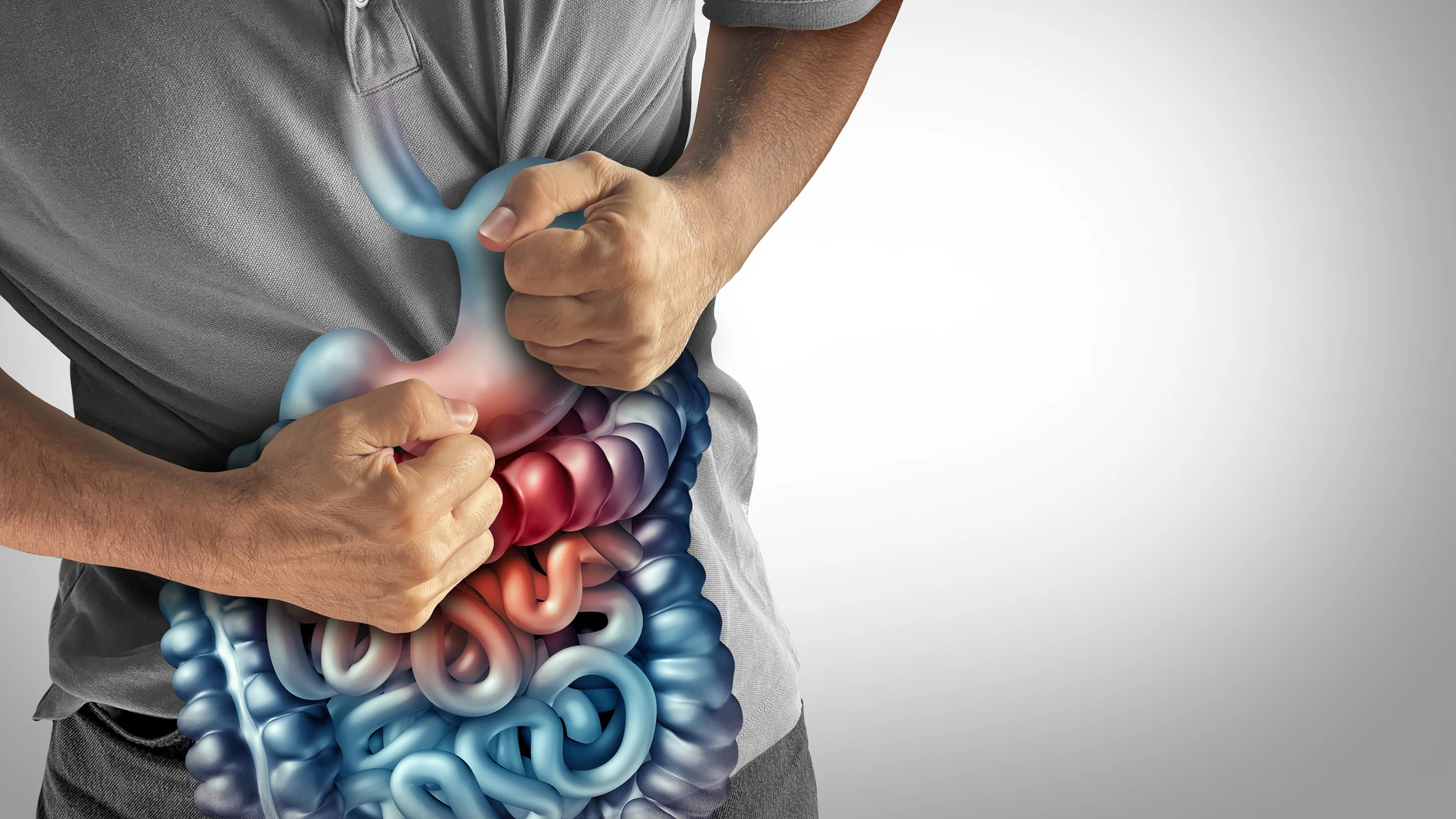 La colitis ulcerosa es una enfermedad inflamatoria intestinal crónica