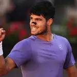 Italian Tennis Open