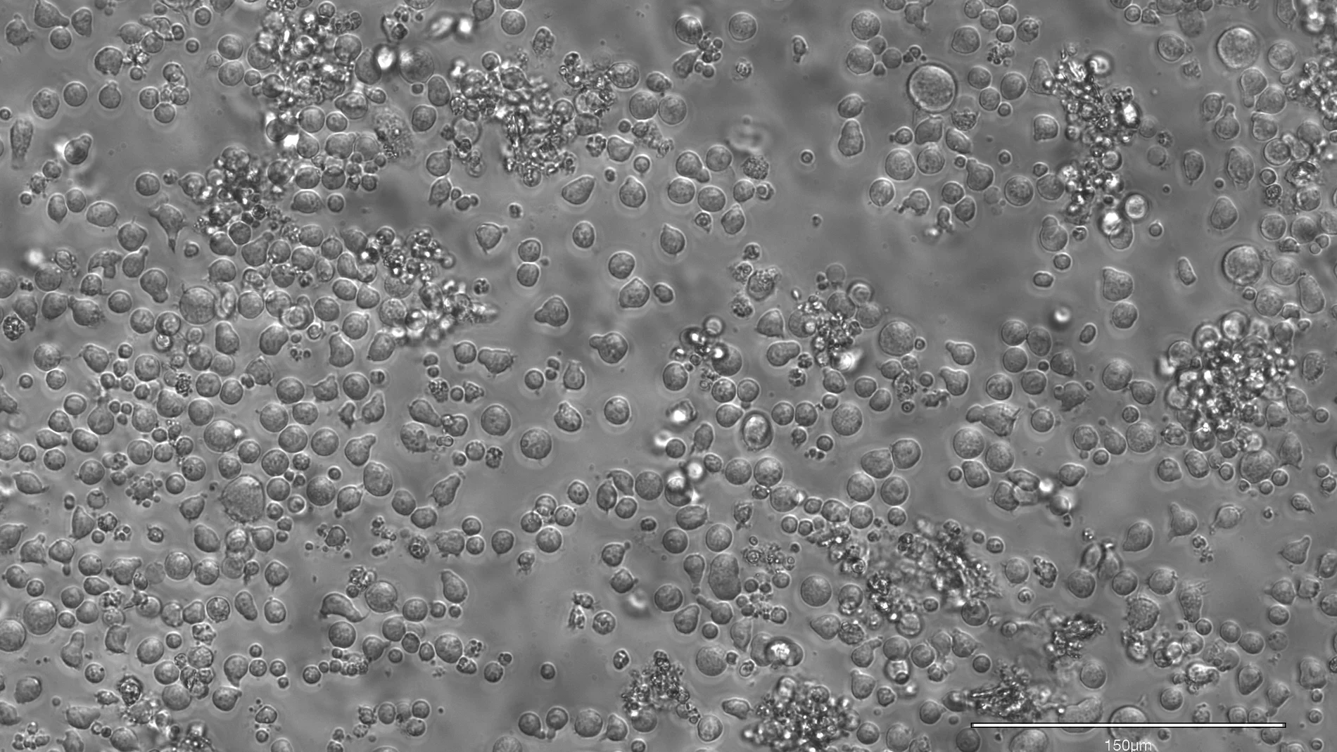 Células madre hematopoyéticas de ratón tras 12 días de cultivo
