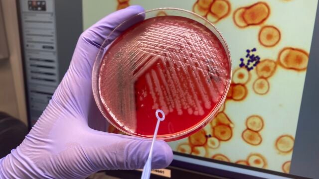 Imagen de una placa de Pseudomonas aeruginosa