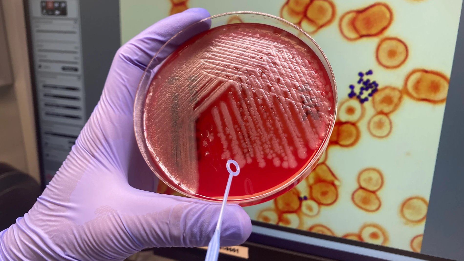 Imagen de una placa de Pseudomonas aeruginosa