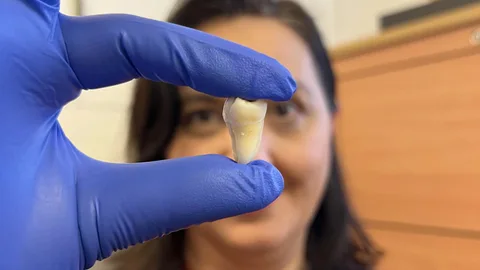 La Dra. Ana Angelova Volponi muestra un diente humano cultivado en laboratorio