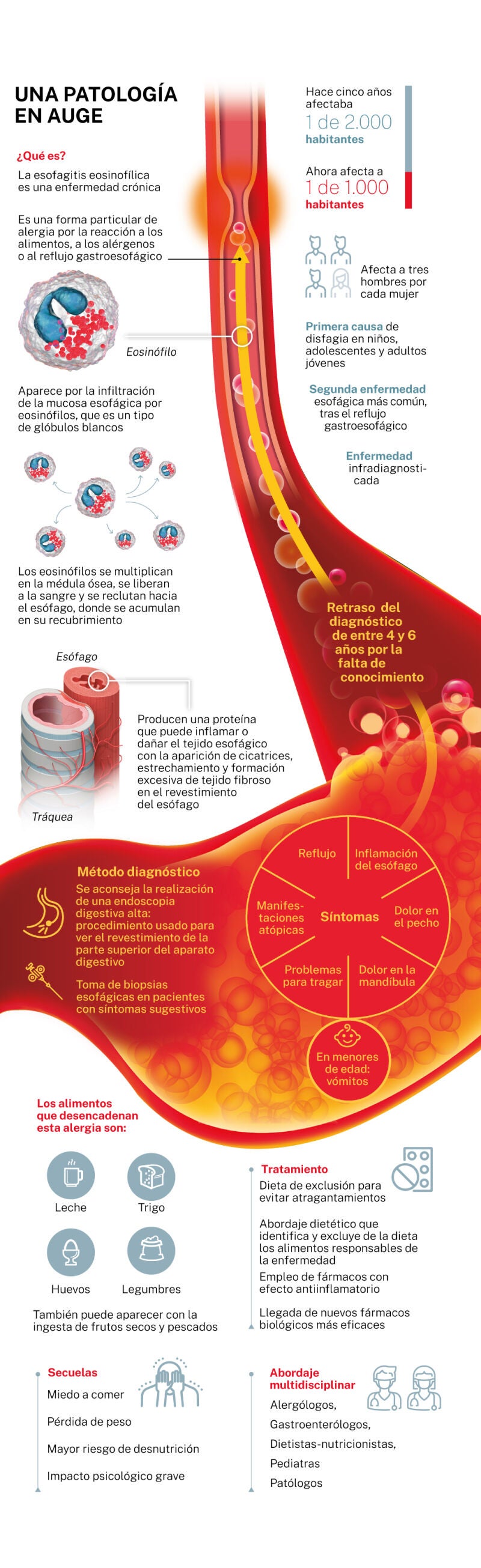 Esofagitis