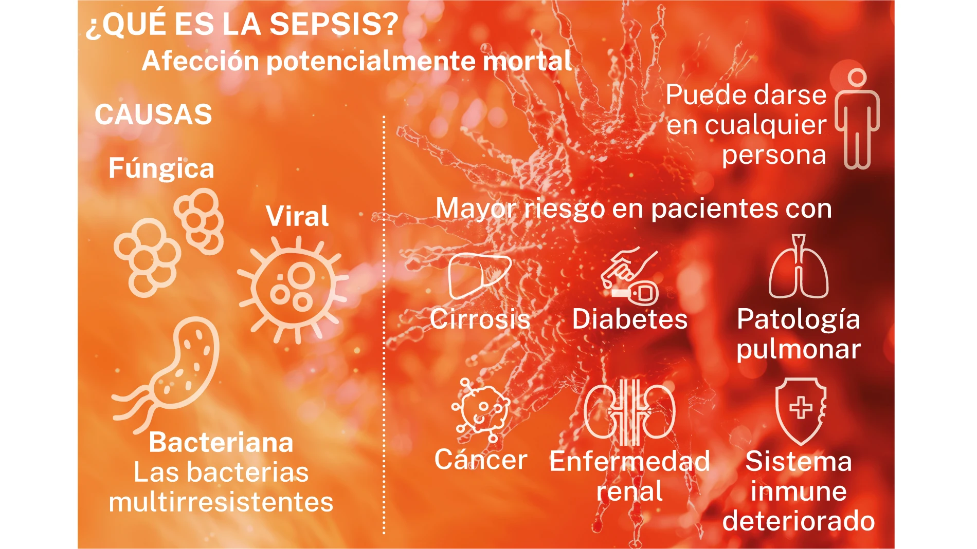 Sepsis