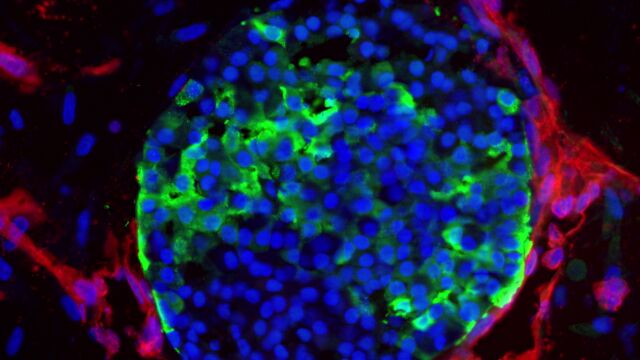 Los investigadores han ideado las condiciones adecuadas para cultivar islotes de células madre vascularizados. La imagen muestra la vasculatura (en rojo) fuertemente envuelta alrededor de las células productoras de insulina (en verde) en los islotes (en azul).