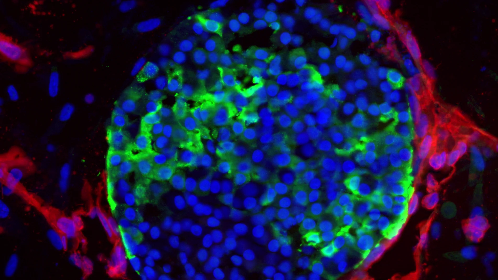 Los investigadores han ideado las condiciones adecuadas para cultivar islotes de células madre vascularizados. La imagen muestra la vasculatura (en rojo) fuertemente envuelta alrededor de las células productoras de insulina (en verde) en los islotes (en azul).