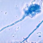 Aspergillus fumigatus