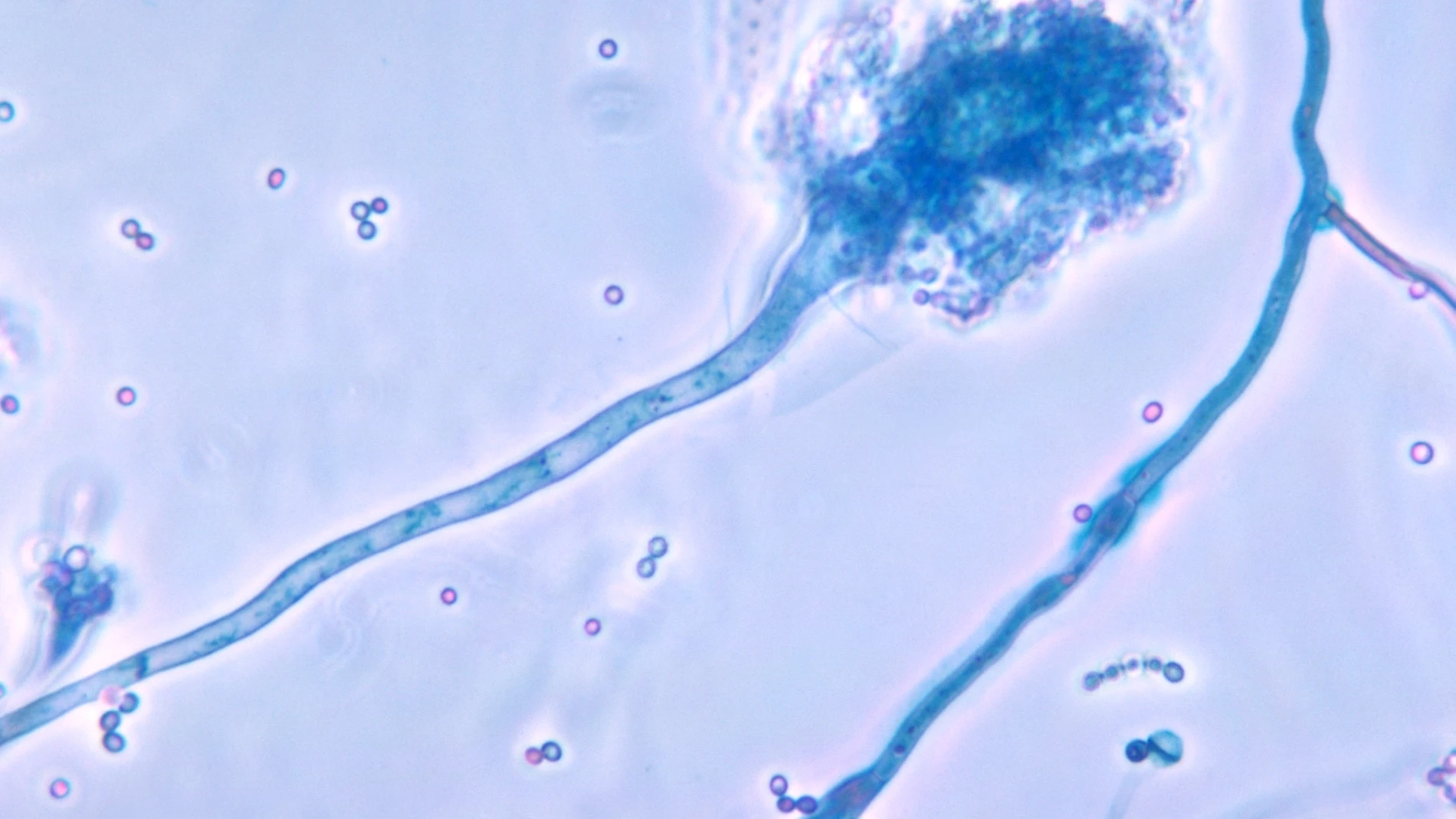 Aspergillus fumigatus