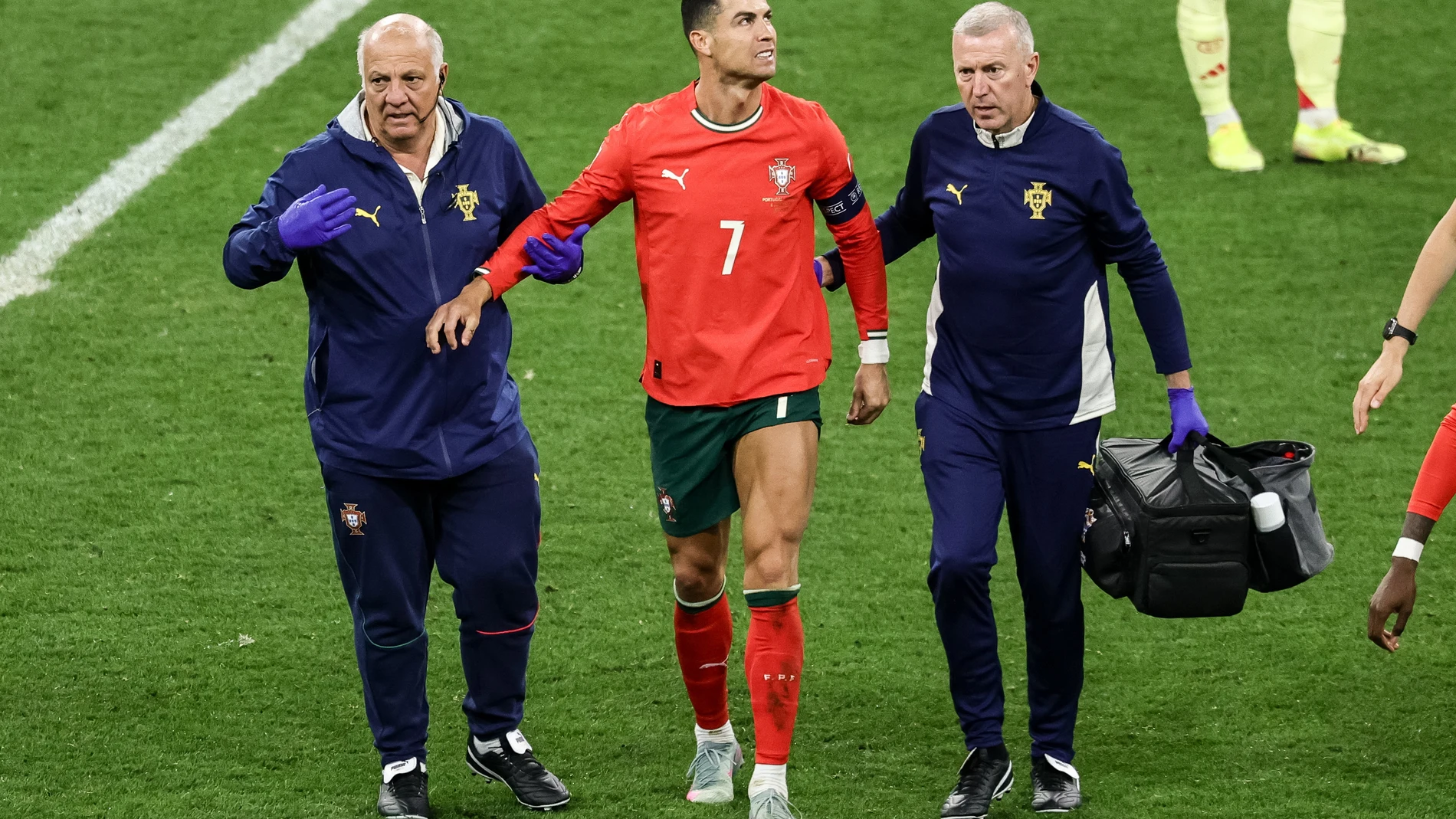 Munich (Germany), 08/06/2025.- Cristiano Ronaldo of Portugal is accompanied for substition after injuring during the UEFA Nations League final match between Portugal and Spain in Munich, Germany 08 June 2025. (Alemania, España) EFE/EPA/FILIP SINGER