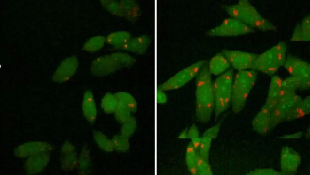 Imágenes microscópicas muestran el aumento de la presencia de material cubosómico encontrado en las células (derecha) en comparación con los liposomas (izquierda)