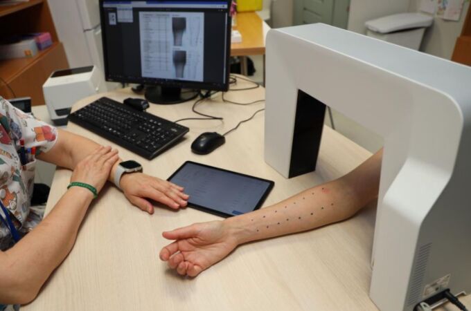 El Hospital Universitario de Toledo incorpora una nueva herramienta digital para la lectura de las pruebas cutáneas del servicio de Alergología.