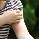 El gadget que alivia picaduras sin cremas ni químicos: funciona con calor y luz LED