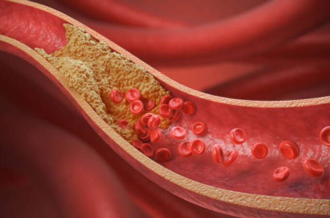 Cardiólogo comparte una de las maneras más efectivas para bajar el colesterol: "Es bueno y salva vidas"
