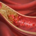 Cardiólogo comparte una de las maneras más efectivas para bajar el colesterol: "Es bueno y salva vidas"