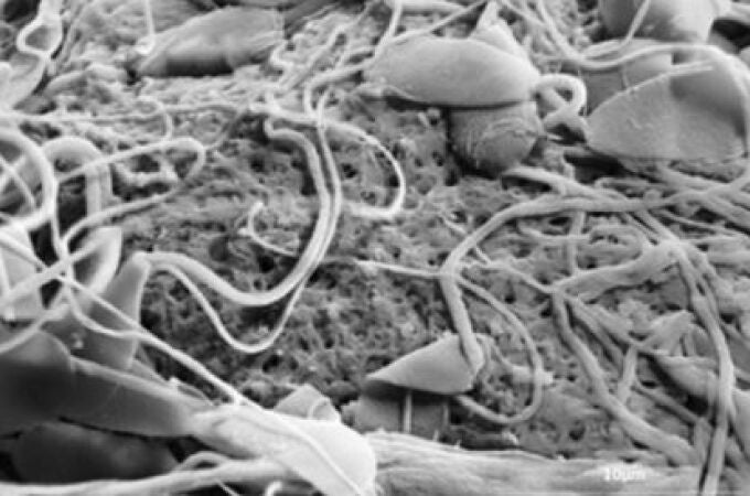 Espermatozoides sobre el óvulo