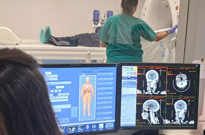 El uso de una terapia con radiofármacos ya ha funcionado con éxito en otros tumores