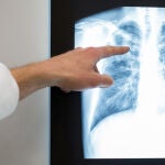 Investigadores publican un 'mapa' sobre la tuberculosis zoonótica, enfermedad transmitida de animales a personas