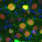 Imagen de microscopía confocal que muestra células de la amígdala basolateral