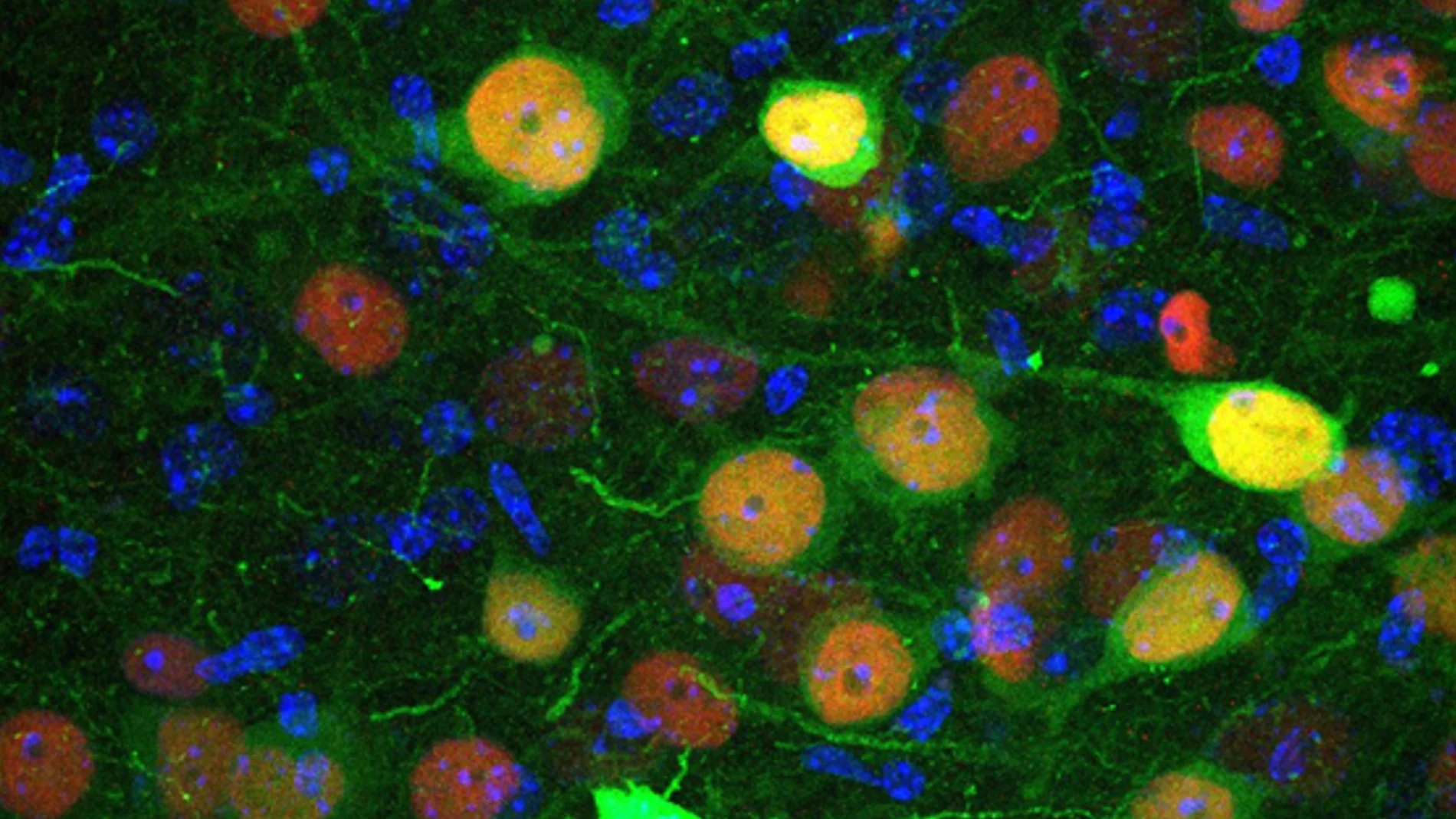 Imagen de microscopía confocal que muestra células de la amígdala basolateral